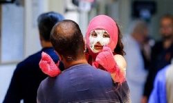 افزایش مصدومان چهارشنبه سوری لرستان به ۳۱ نفر