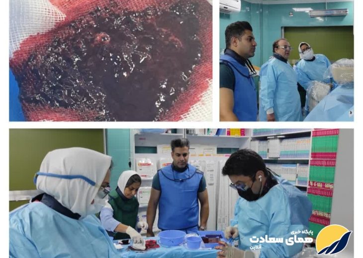 انجام‌ موفقیت آمیز عمل جراحی سنگین در بیمارستان مدنی خرم‌آباد
