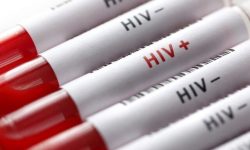 ارائه ۵ هزار خدمت به افراد در معرض خطر ابتلاء به HIV در لرستان