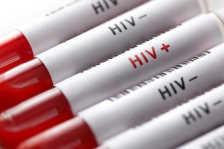 ارائه ۵ هزار خدمت به افراد در معرض خطر ابتلاء به HIV در لرستان