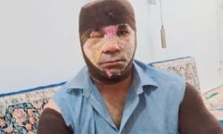 نجات راننده نیسان از دل آتش توسط جوان شجاع پلدختری