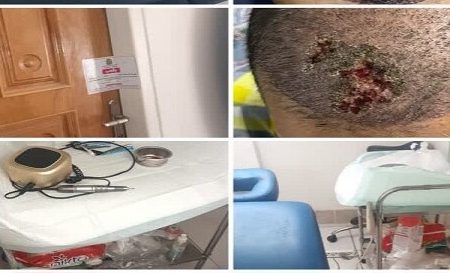 پلمب مرکز غیرمجاز کاشت مو در خرم‌آباد