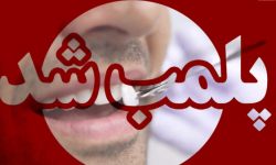 پلمب دندانپزشکی غیرمجاز در خرمآباد