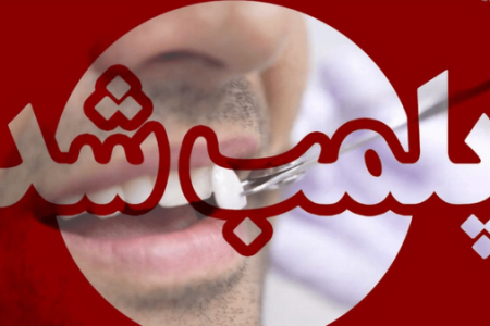پلمب دندانپزشکی غیرمجاز در خرم‌آباد