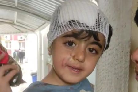 مرگ بر آمریکا از حنجره زخمی کودک ۳ ساله خرم‌آبادی