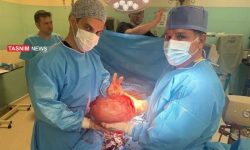 خروج توده ۷ کیلویی از شکم بیمار کوهدشتی